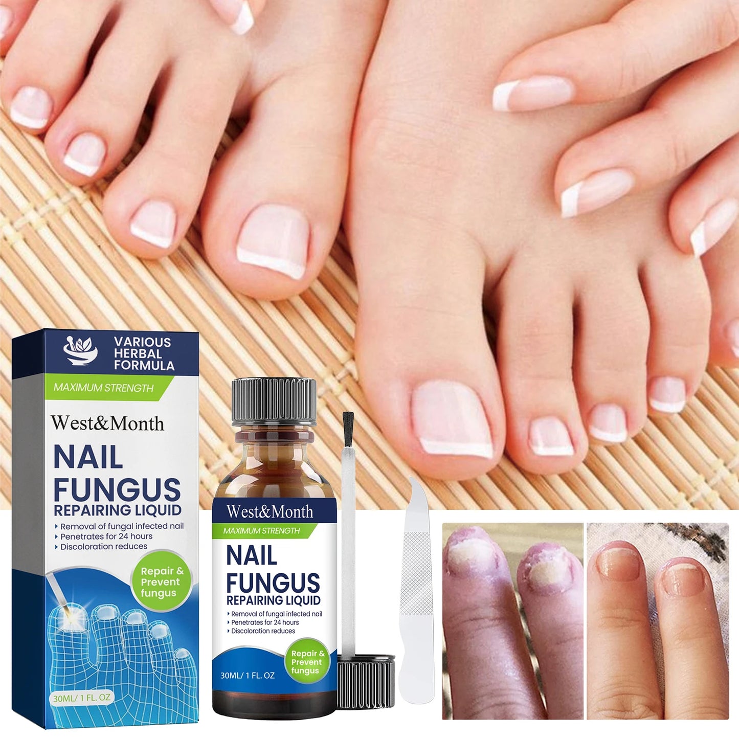Maximum Strength Nail Fungus Repairing Liquid