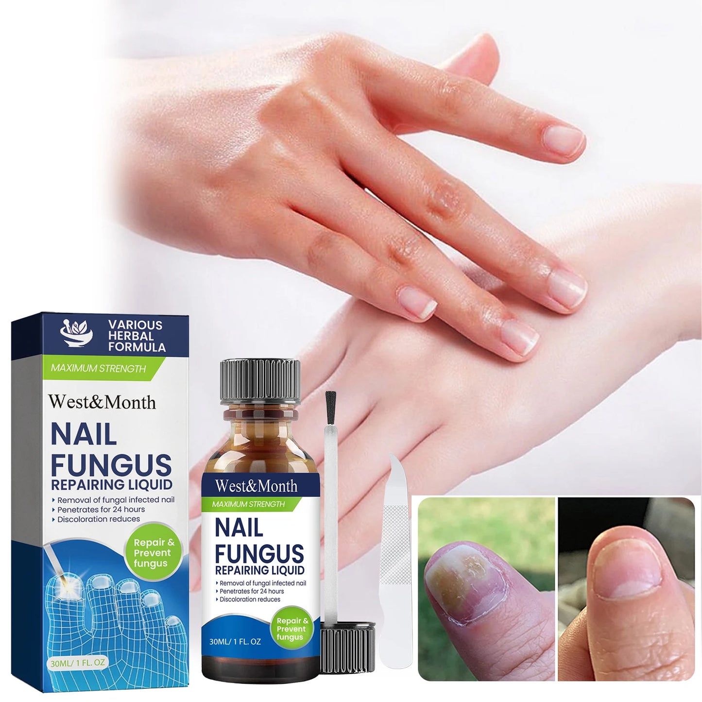 Maximum Strength Nail Fungus Repairing Liquid