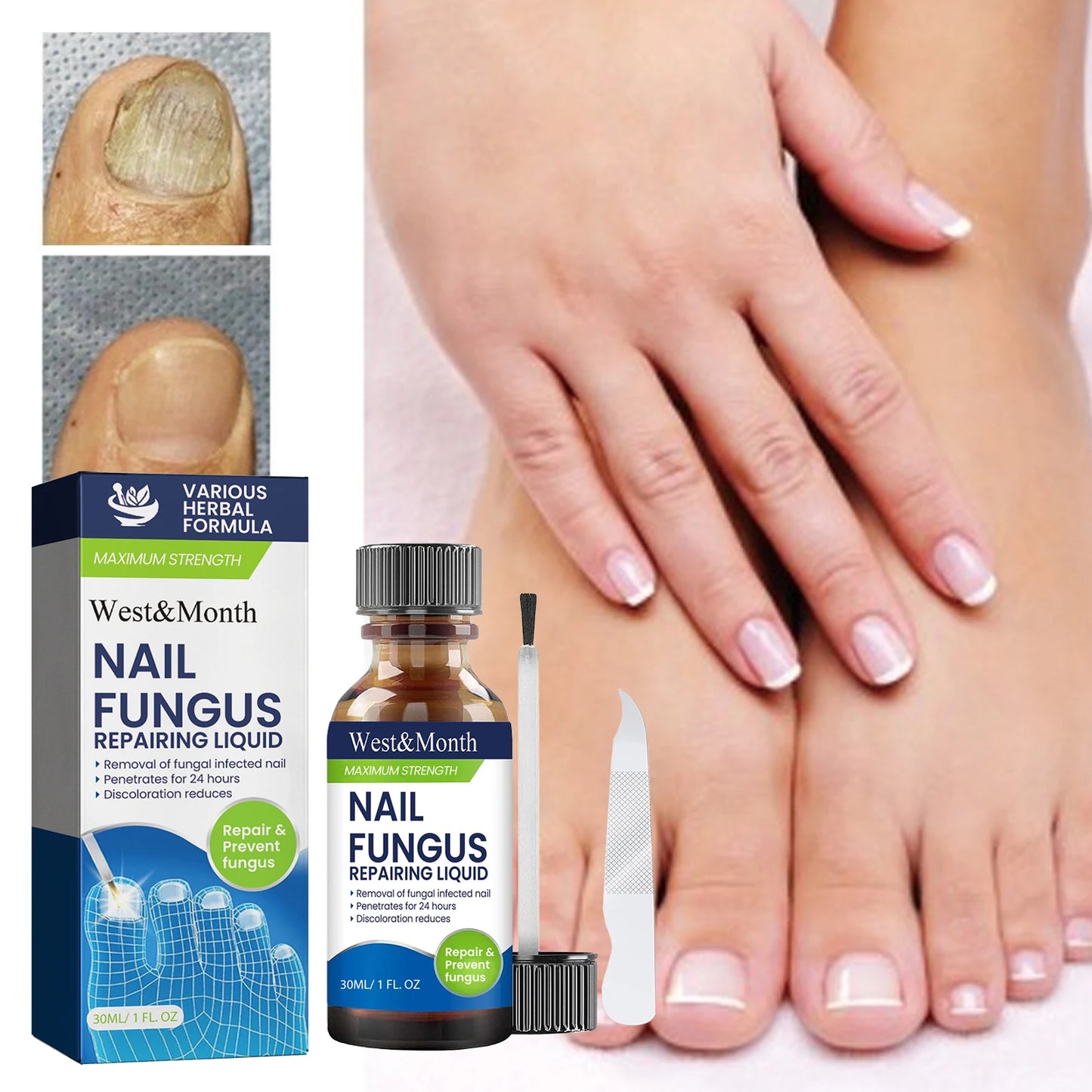 Maximum Strength Nail Fungus Repairing Liquid