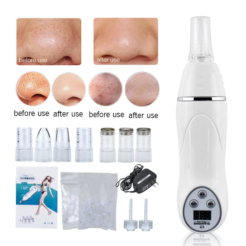 Microdermabrasion Machine Vacuum Blackhead Acne Remove Face Cleaning Skin Peel
Diamond Dermabrasion Facial Pore Cleaner Equipment