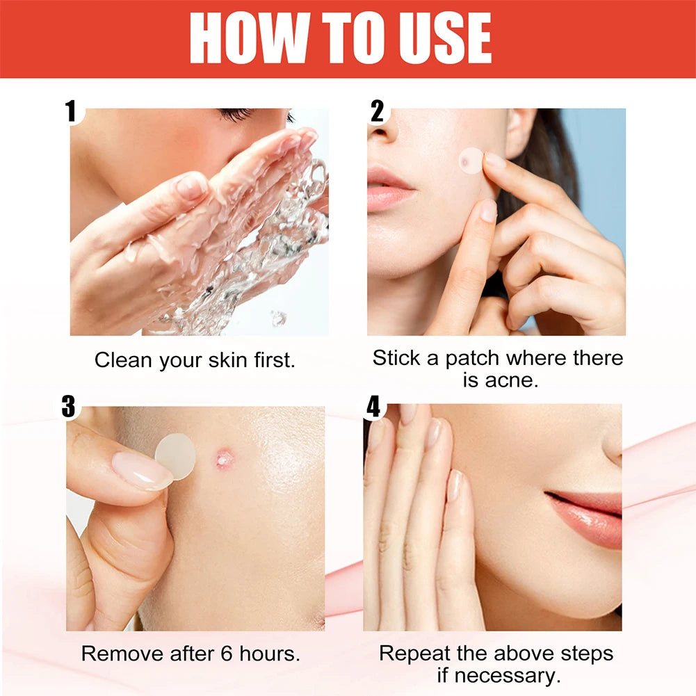 144pcs/set Face Skin Care Acne Pimple Patch 2 Sizes
Invisible Professional Healing Absorbing Spot Sticker