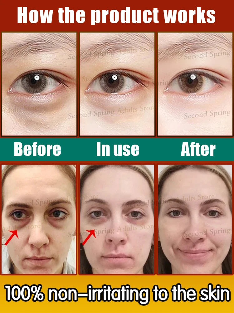 90% of buyers say the eyes bag will never be an issue!!