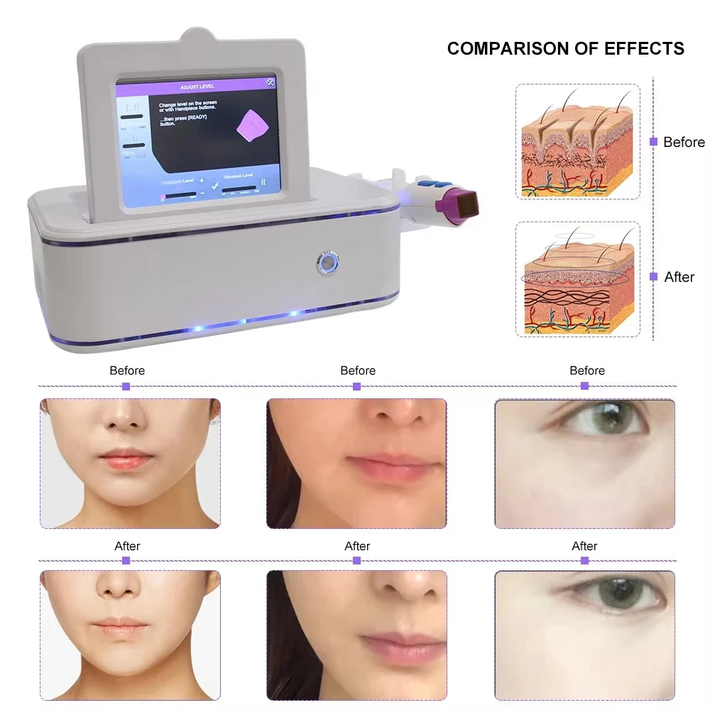 3 IN 1 Skin Care Face Lift Fractional Firming Machine Firming Beauty Tools Anti-Aging Wrinkle Reducer Recommended Items For 2025