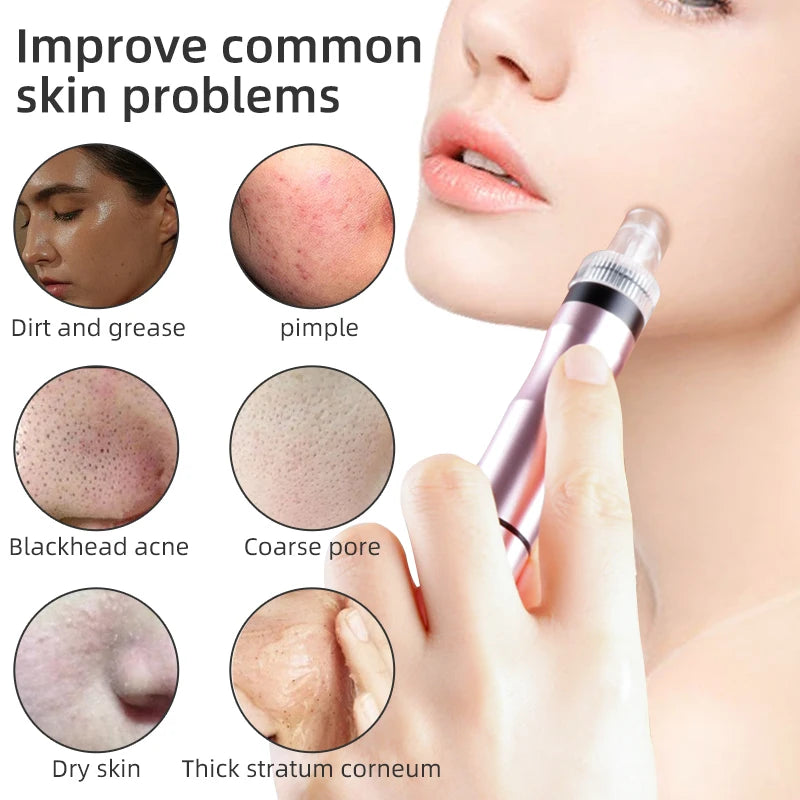 Small Bubble Cleansing Machine Blackhead Removal
Water Hydro Jet Beauty Tool Face Pores Vacuum Suction Acne Cleaner