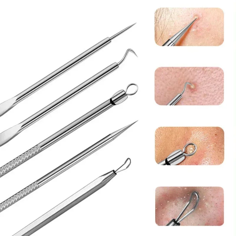 Pimples Blackhead Clip Tweezers Special Blackhead Remove r Acne Needle Tool