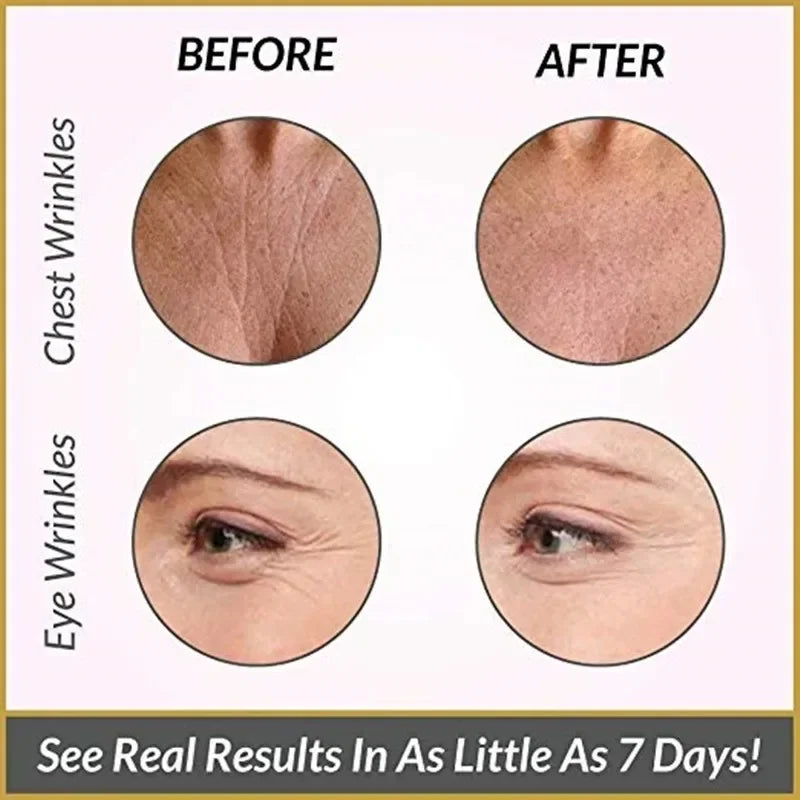 Reusable Silicone Wrinkle Removal Sticker Facial Lifting Strips
For Forehead Neck Line Remover Eye Patches Anti Aging Skin Pads