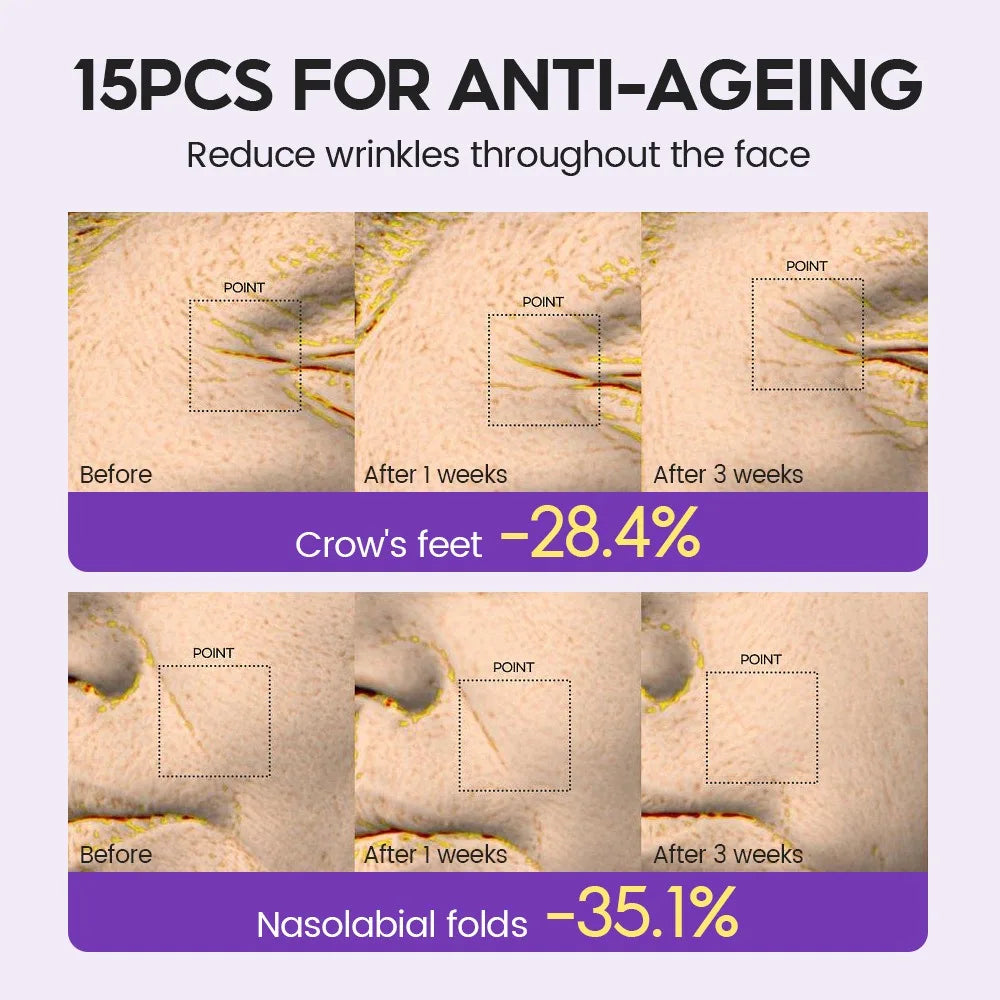 Retinol + Pro-xylane Ampoule serum
Repairs Strengthens The Skin And Diminishes Fine Lines Face Beauty Skin Care 15pcs