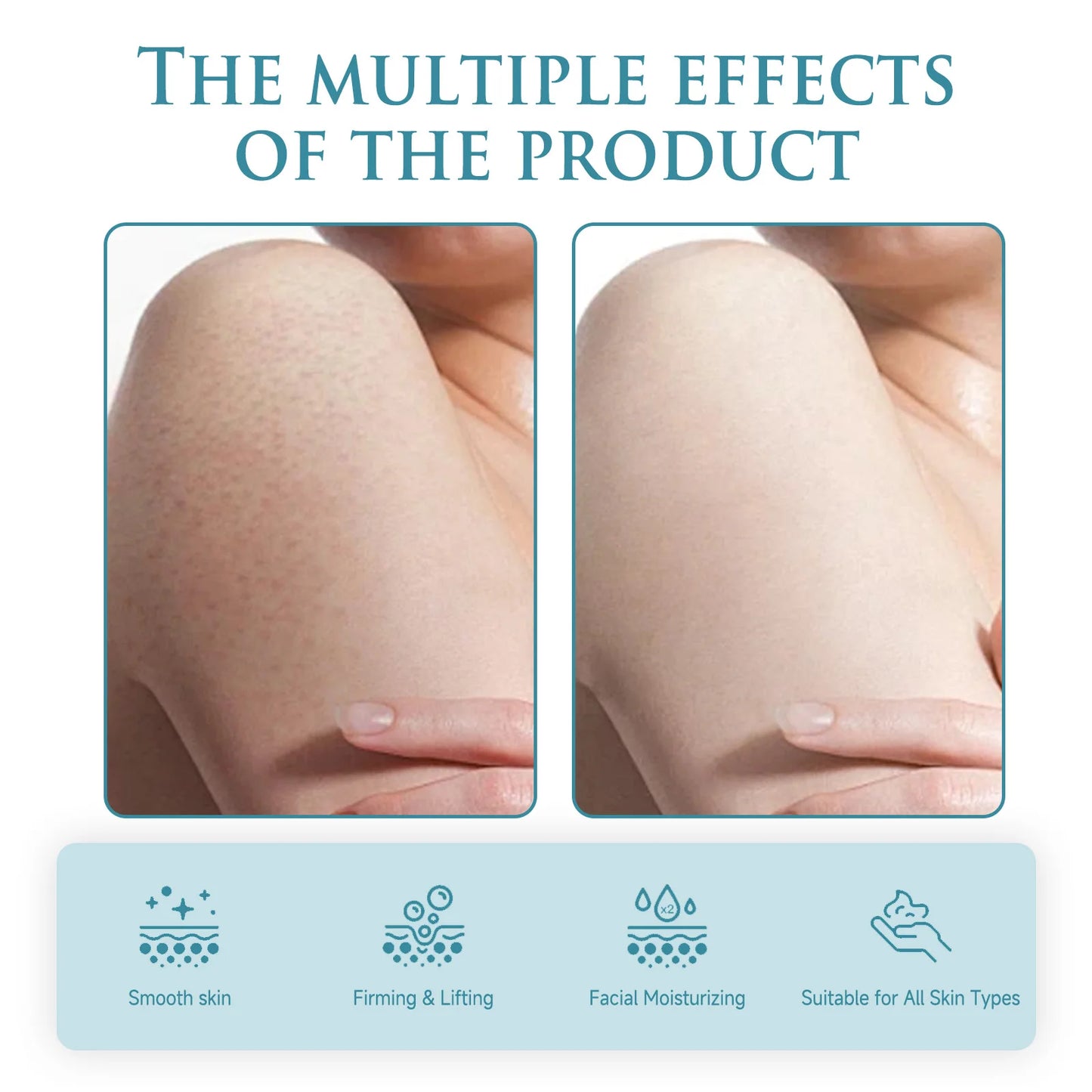 Niacinamide Body Anti-wrinkle Cream Body Lotion Lighten Fine Lines