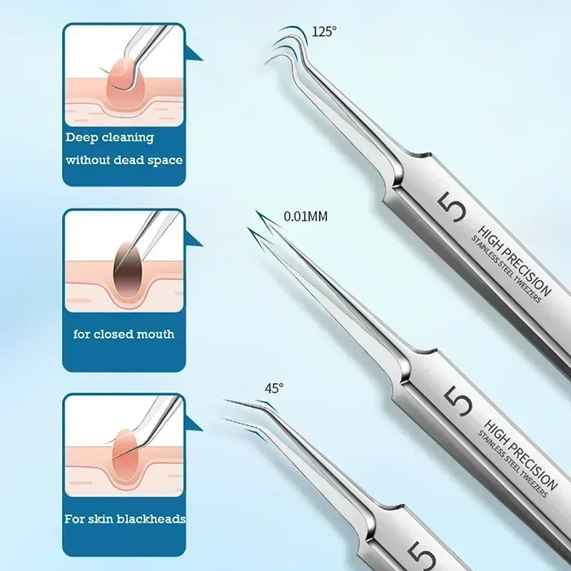 Pimples Blackhead Clip Tweezers Special Blackhead Remove r Acne Needle Tool