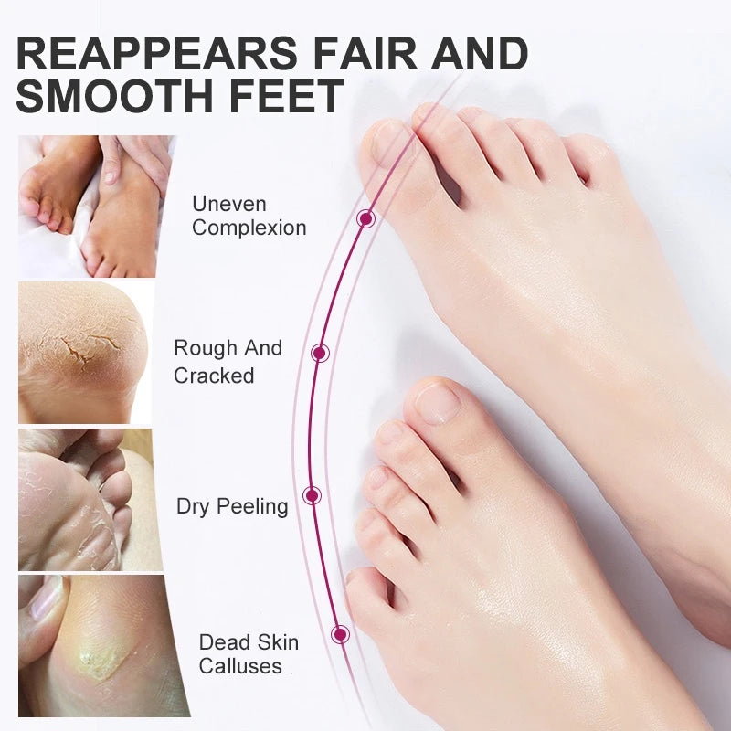 Foot Peel Mask, Exfoliating Peel Off Calluses Dead Skin Callus Remover Dry Cracked Feet,
Baby Soft Smooth Touch Feet Skin