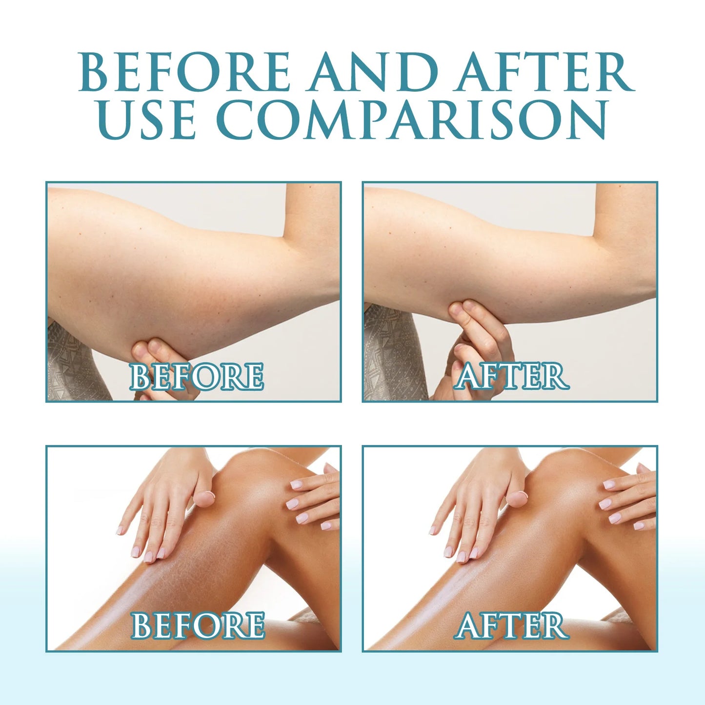 Niacinamide Body Anti-wrinkle Cream Body Lotion Lighten Fine Lines