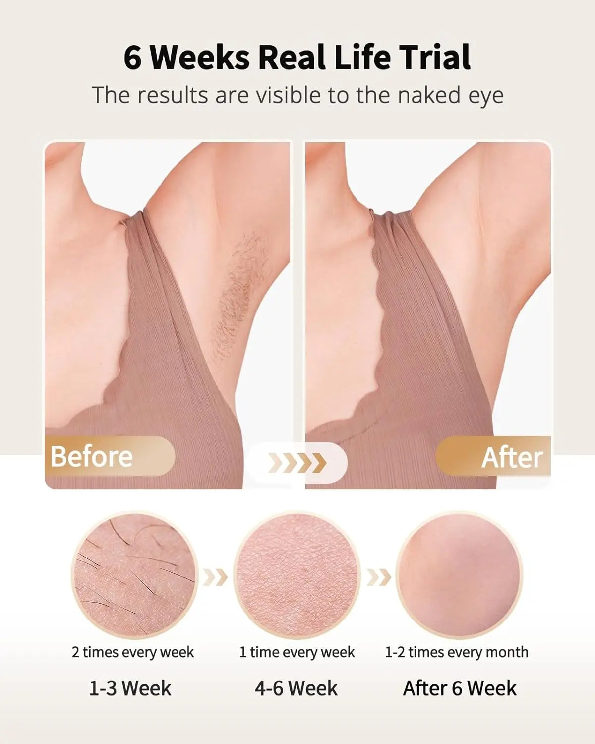 Laser Hair Removal with Ice Cooling Care Function for Women Men Hair Remover for anywhere on the body