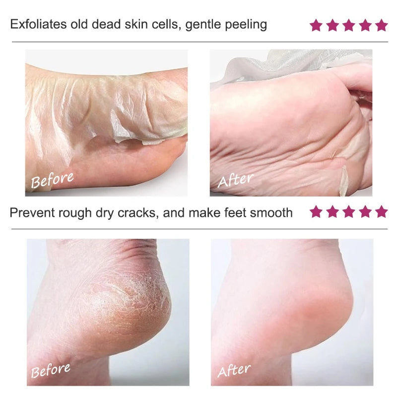 Foot Peel Mask, Exfoliating Peel Off Calluses Dead Skin Callus Remover Dry Cracked Feet,
Baby Soft Smooth Touch Feet Skin