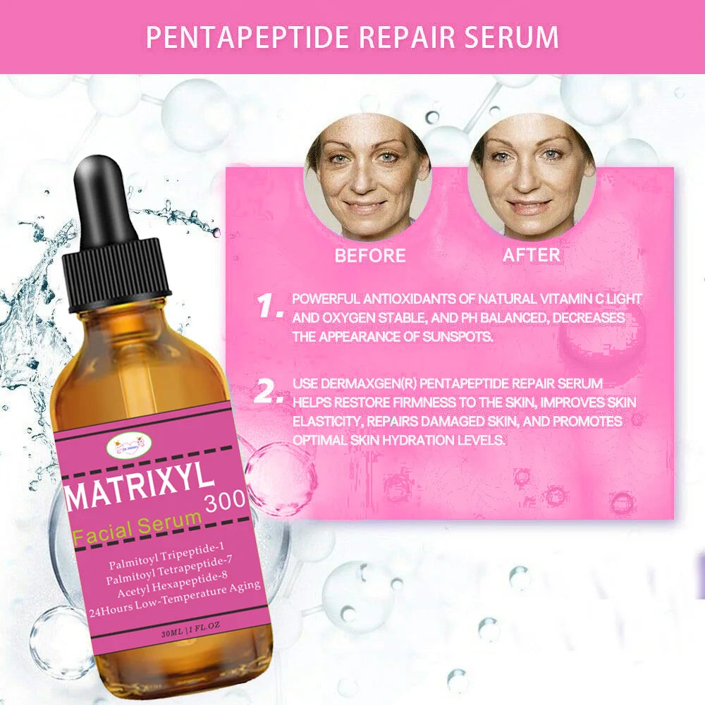 2pcs Matrixyl 3000 + Argireline + Hyaluronic Acid + Organic Vitamin C Serum for Face, Facial Skin Serum Skin Care Products