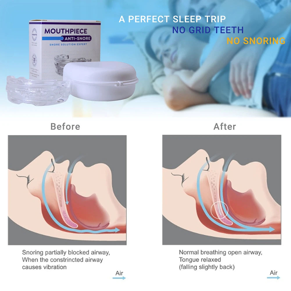 Mouth Guard Anti-Snoring Teeth Bruxism Mouthguard
Improves Sleep Teeth Bruxism Sleep and Apnea Snoring Device Stops Snoring