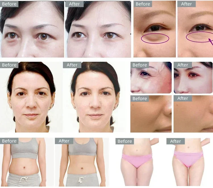 3in1 40K Cavitation Ultrasonic Weight Loss Lifting Wrinkle Firming Skin Slimming Body Massage Shaping Beauty Instrument