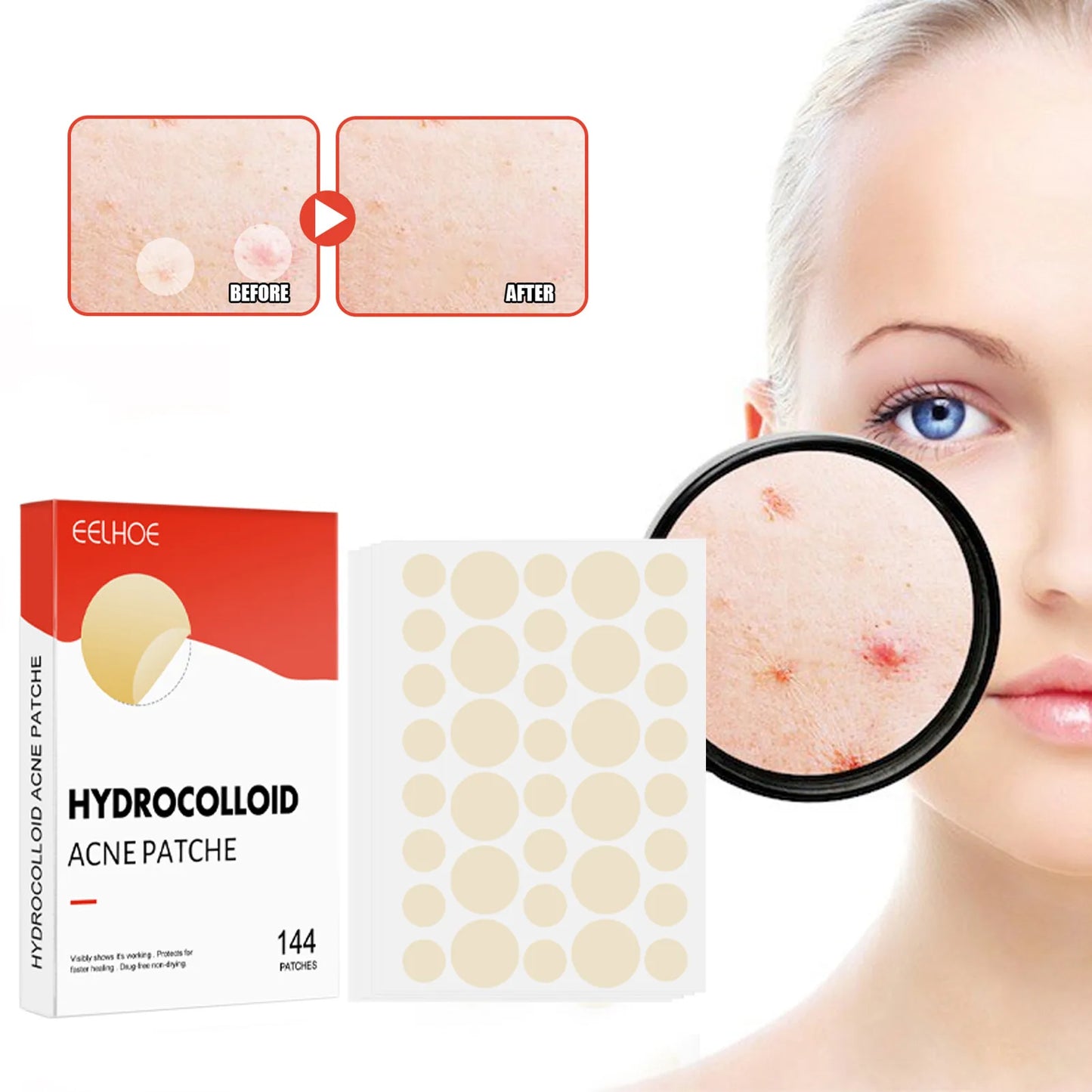 144pcs/set Face Skin Care Acne Pimple Patch 2 Sizes
Invisible Professional Healing Absorbing Spot Sticker