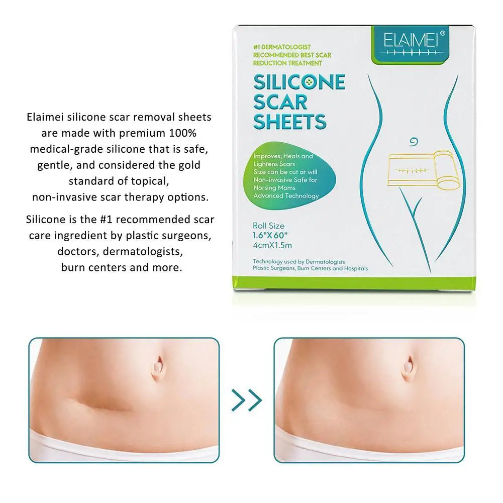 150cm Silicone Gel Scar Sheet Patch Treatment Removal Tape Acne Trauma Burn Scar Cover Skin Repair