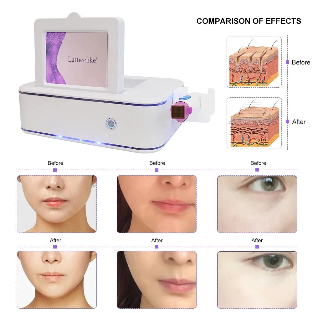 5th Portable Therma Flx Fractional RF Machine
Skin tightening Anti-aging Wrinkle Remover Beauty Machine