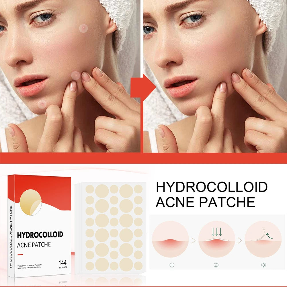 144pcs/set Face Skin Care Acne Pimple Patch 2 Sizes
Invisible Professional Healing Absorbing Spot Sticker