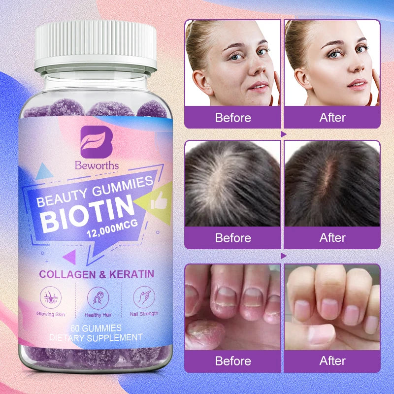 Vitamin Biotin Gummies 12,000 mcg for Stronger Hair, Skin & Nails - 60 Gummies