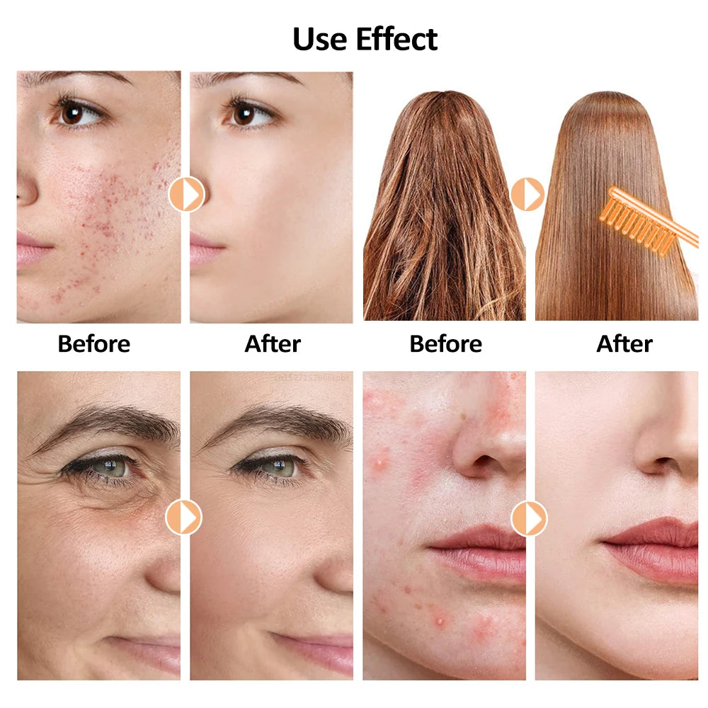 High Frequency Electrode Wand Neon Argon Electrode Glass Tube
Skin Tightening Remove Wrinkle Acne Spots
