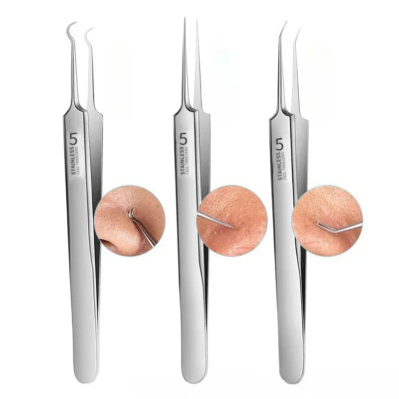 Pimples Blackhead Clip Tweezers Special Blackhead Remove r Acne Needle Tool