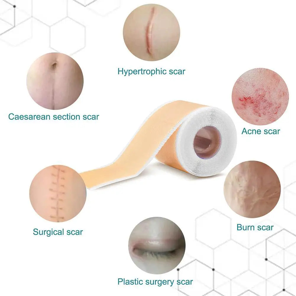 150cm Silicone Gel Scar Sheet Patch Treatment Removal Tape Acne Trauma Burn Scar Cover Skin Repair