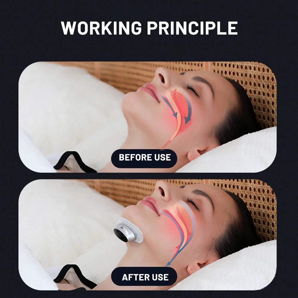 Smart Anti-Snoring Device EMS Anti Snore Solution 
Nerve Stimulation Chin Strap Snoring Prevention Sleep Aids
