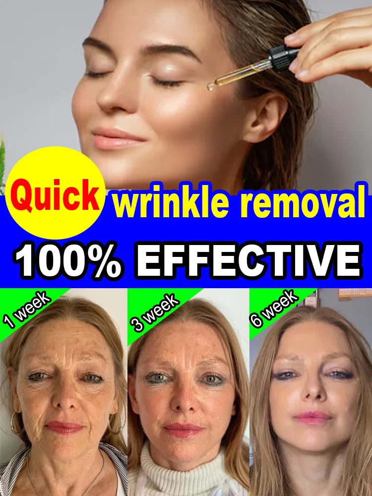 wrinkles disappeared