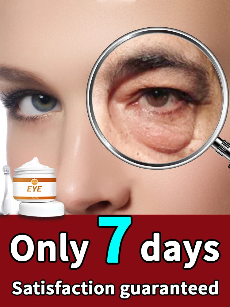 90% of  buyers say the eyes bag will never be an issue!!