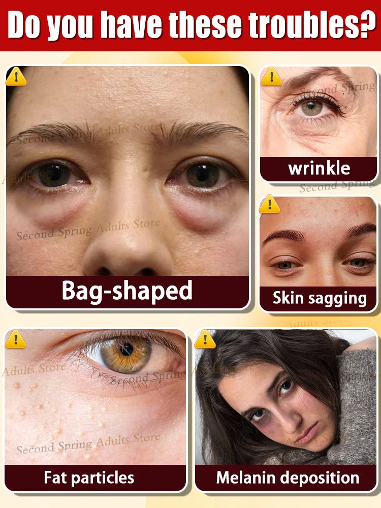 90% of  buyers say the eyes bag will never be an issue!!