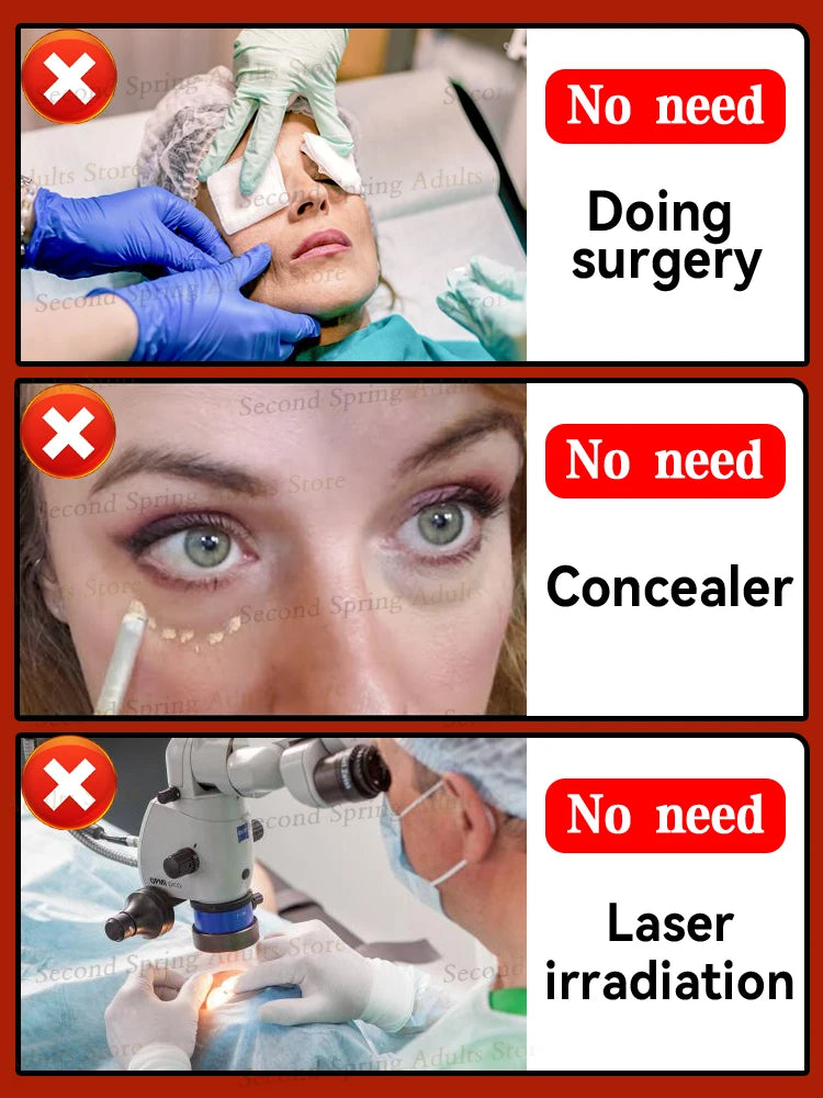 90% of  buyers say the eyes bag will never be an issue!!