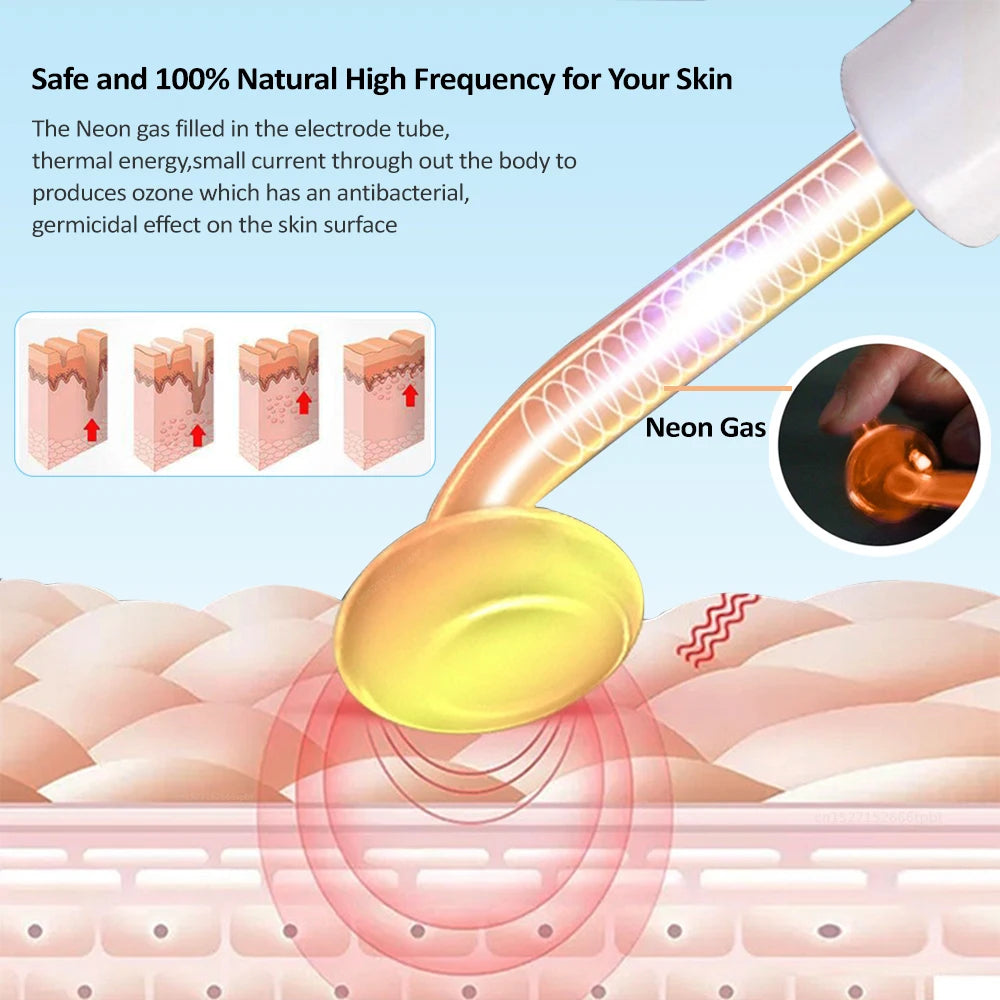 High Frequency Electrode Wand Neon Argon Electrode Glass Tube
Skin Tightening Remove Wrinkle Acne Spots